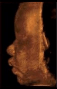 Hva er ultralyd? Illutrasjon av ultralydbilde av et ansikt.