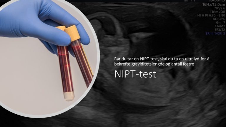 NIPT- test