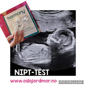 NIPT- test fosterdiagnostikk