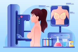 Mammografiprogrammet - slik fungerer det